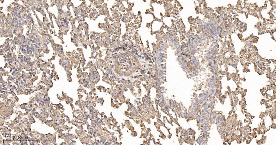 beta Actin Recombinant Rabbit 