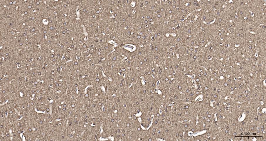 beta I Tubulin Recombinant Rab