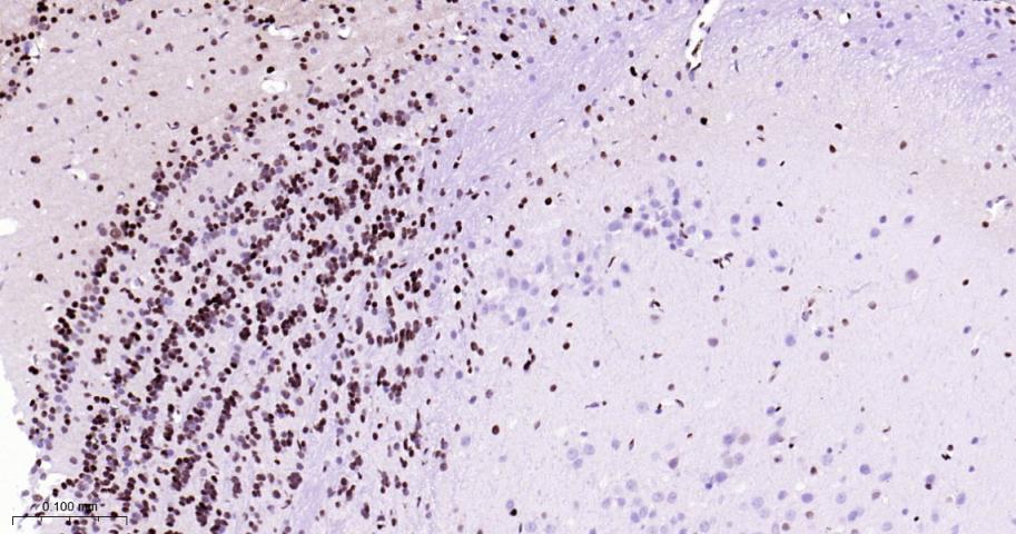 CTBP2 Recombinant Rabbit mAb(b