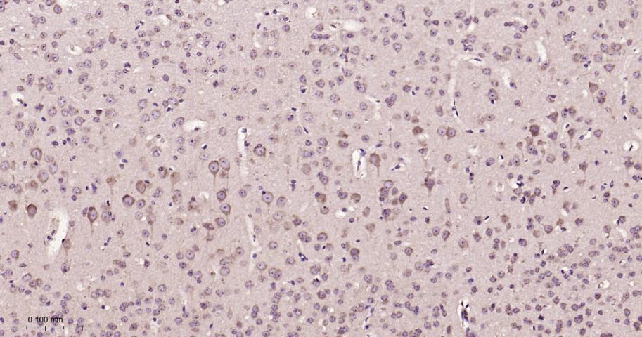 eIF3B Recombinant Rabbit mAb(b