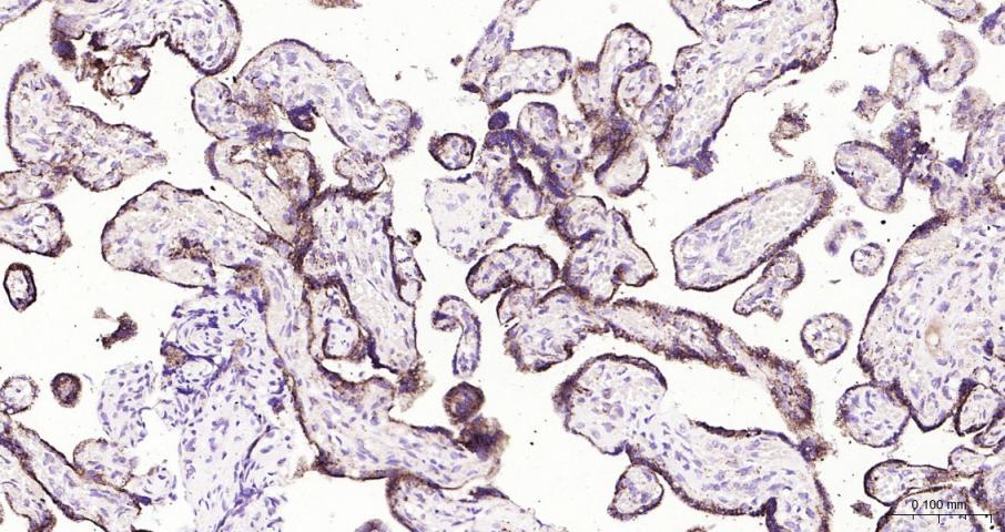 Adrenodoxin Recombinant Rabbit
