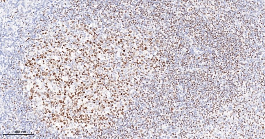Oct-1 Recombinant Rabbit mAb(b