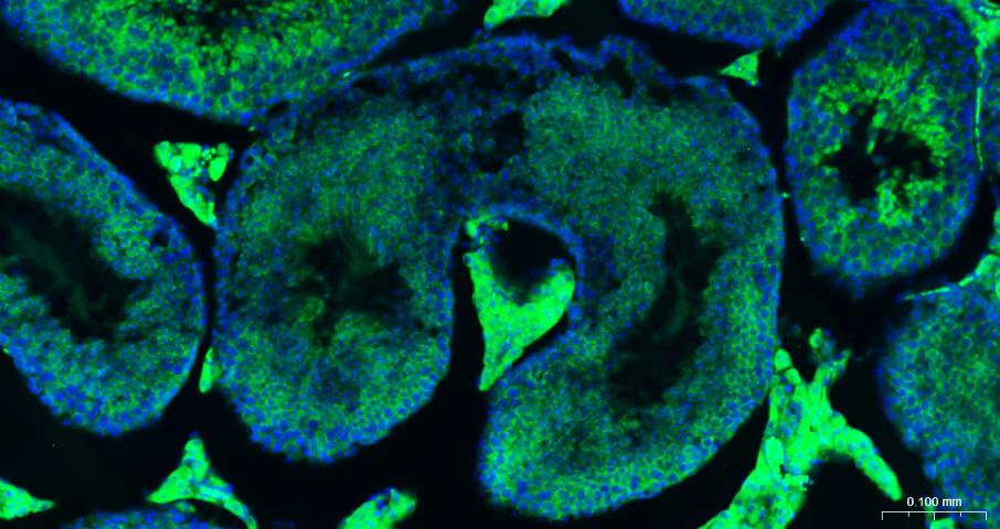 eIF4E Recombinant Rabbit mAb(b