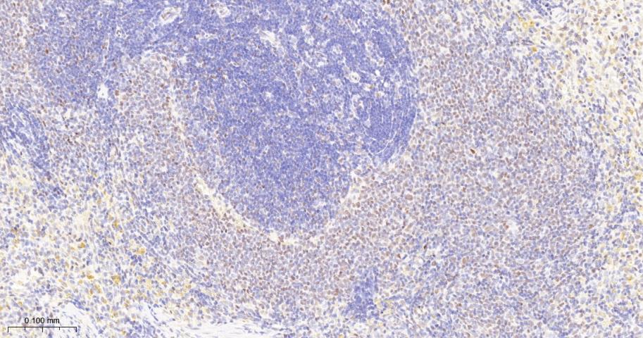 Oct-1 Recombinant Rabbit mAb(b