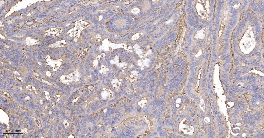 beta Actin Recombinant Rabbit 