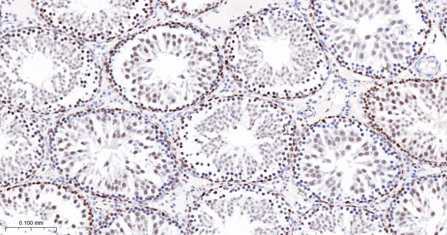 Oct-1 Recombinant Rabbit mAb(b