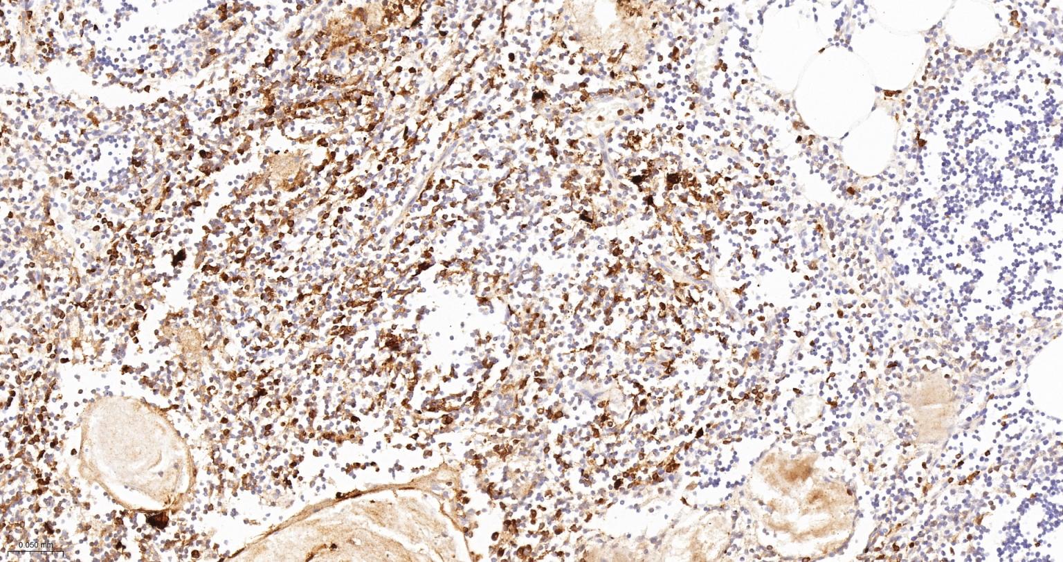 CD16 Recombinant Rabbit mAb(bs