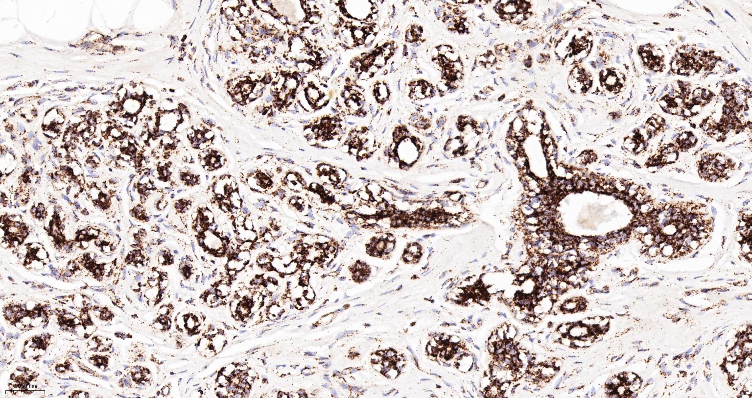 MDH2 Recombinant Rabbit mAb(bs