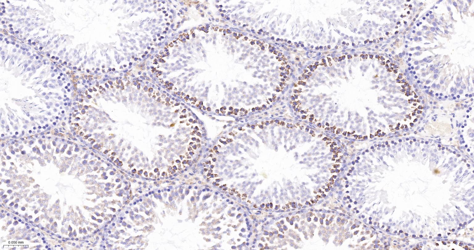MDH2 Recombinant Rabbit mAb(bs