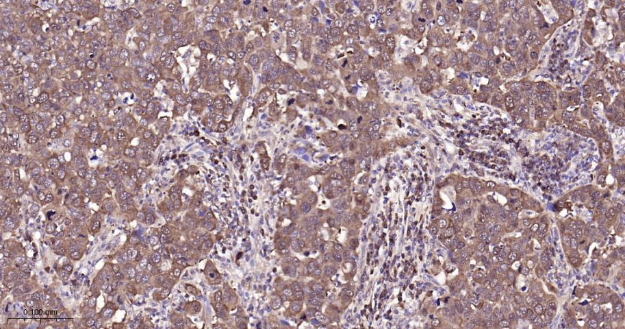 NME1/NM23A Recombinant Rabbit 