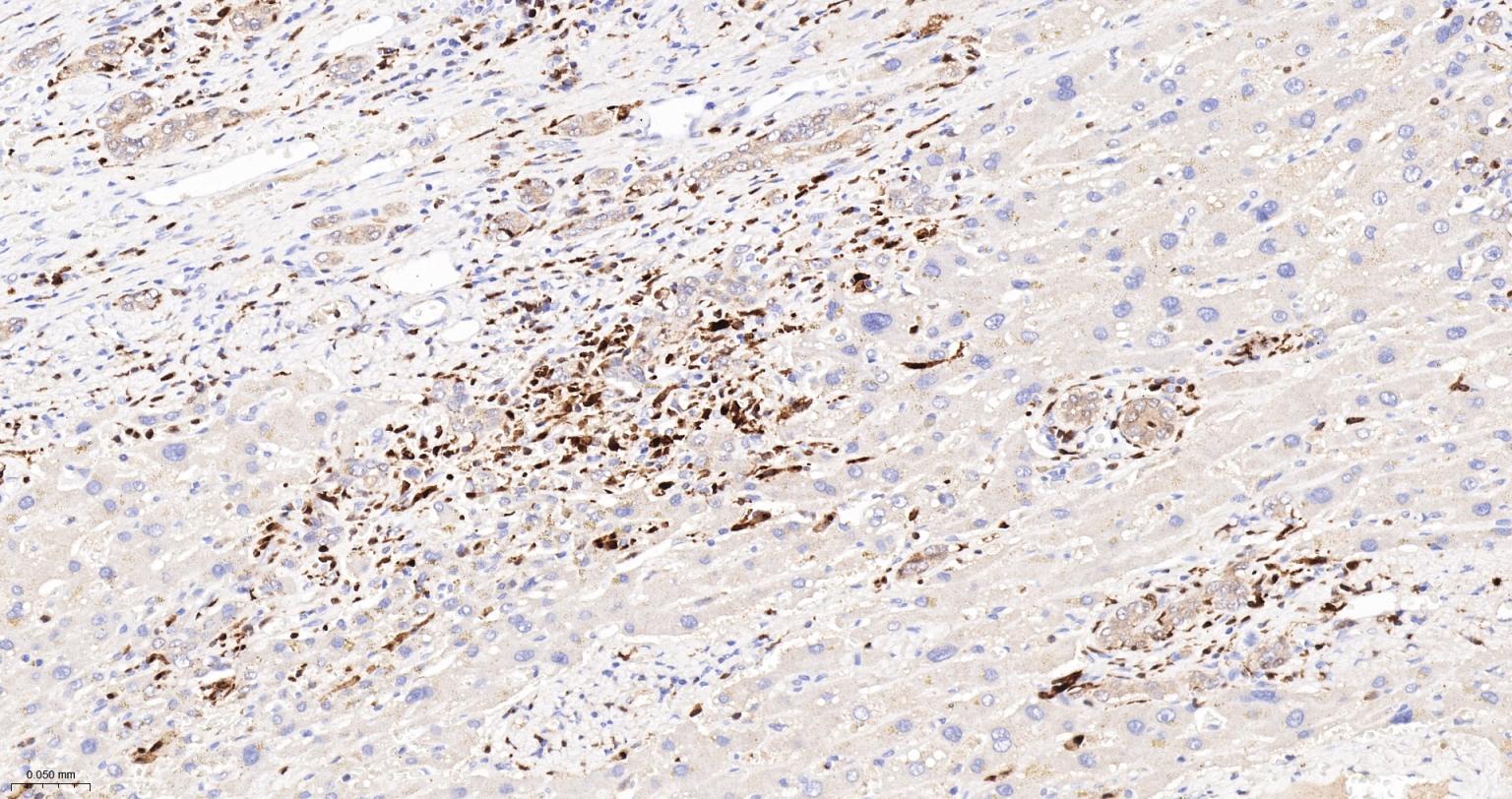 CD16 Recombinant Rabbit mAb(bs