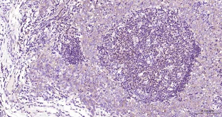 NFKB p65 Recombinant Rabbit mA