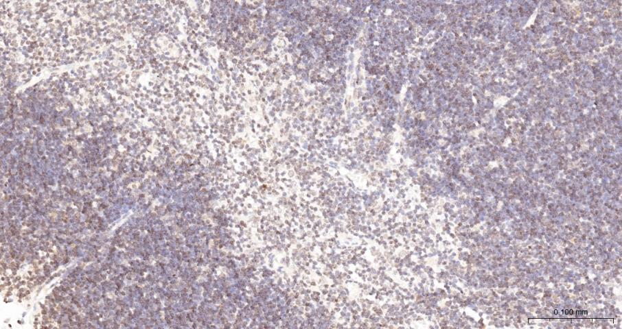 BRCA2 Rabbit pAb(bs-25812R)-50