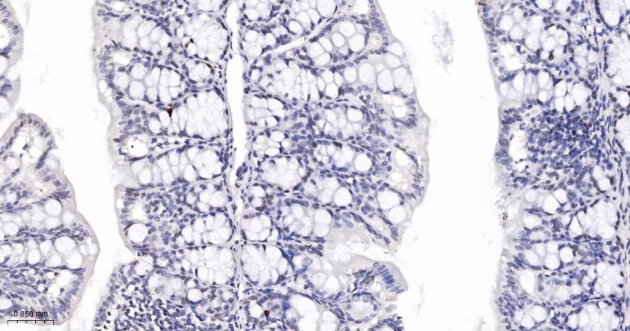 phospho-Histone H3 (S10) Recom