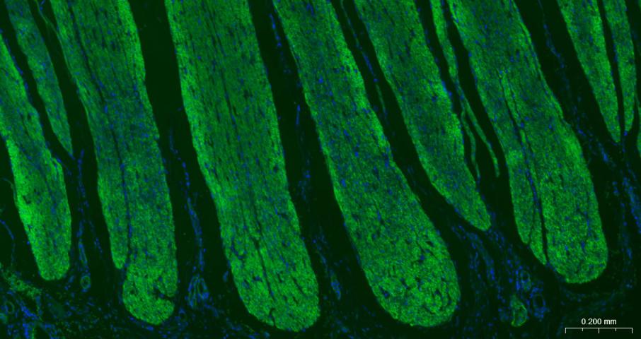 alpha smooth muscle Actin Mous