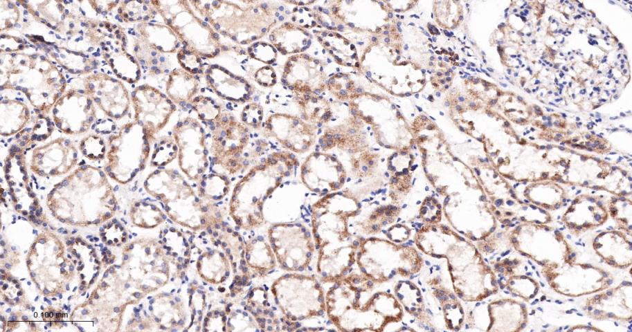 SERCA2 Recombinant Rabbit mAb(