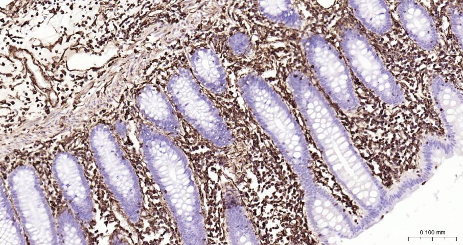 Vimentin Recombinant Rabbit mA
