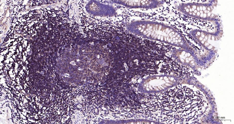 NFKB p65 Recombinant Rabbit mA
