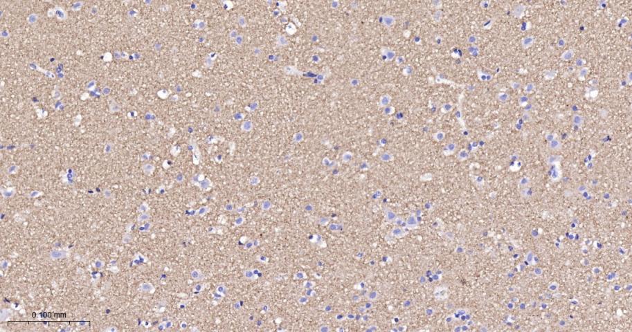 Synapsin II Recombinant Rabbit