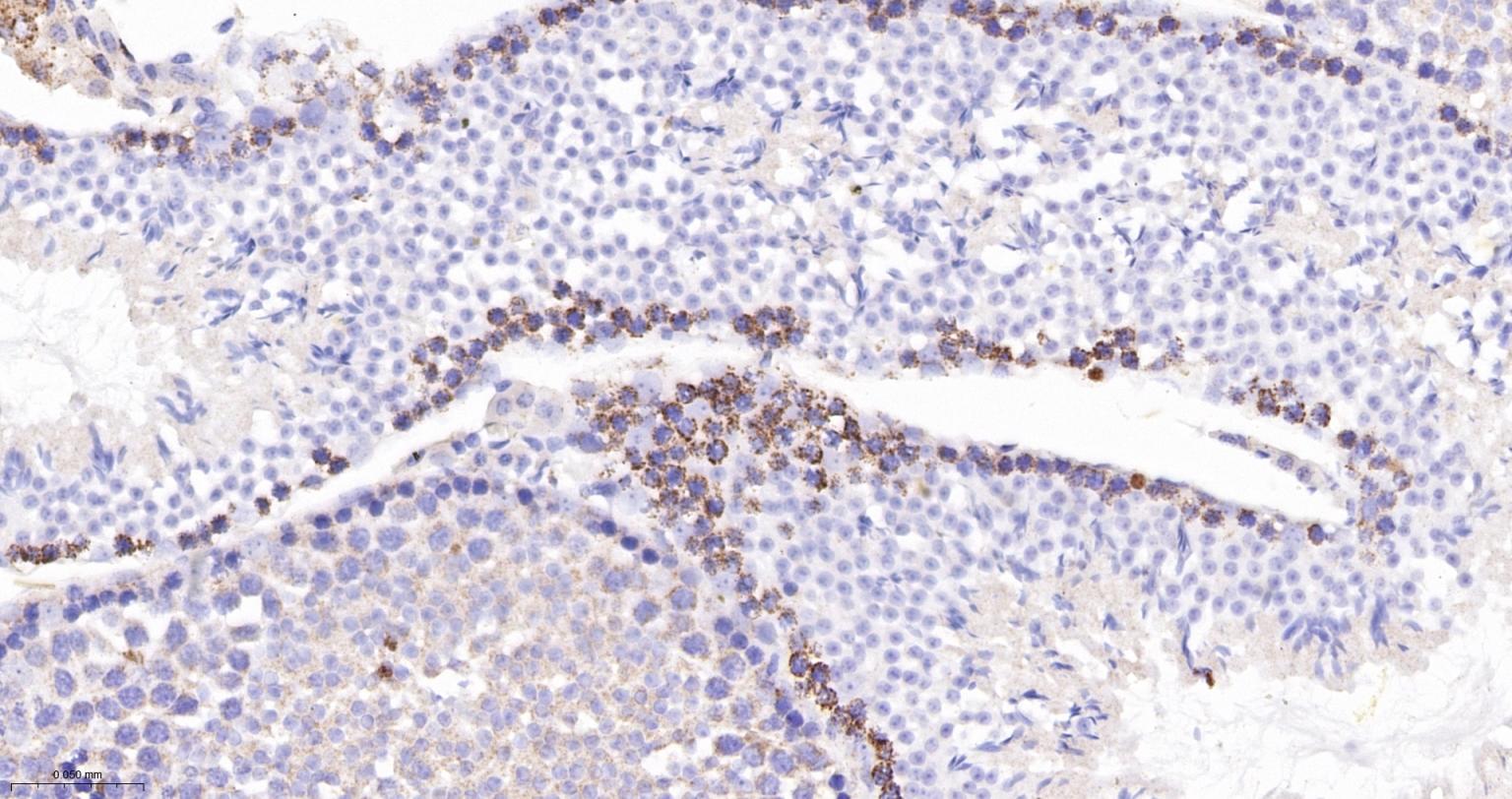 MDH2 Recombinant Rabbit mAb(bs