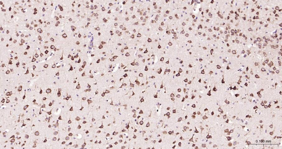 eIF4E Recombinant Rabbit mAb(b