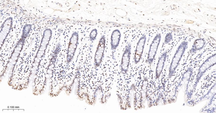 phospho-Histone H3 (S10) Recom