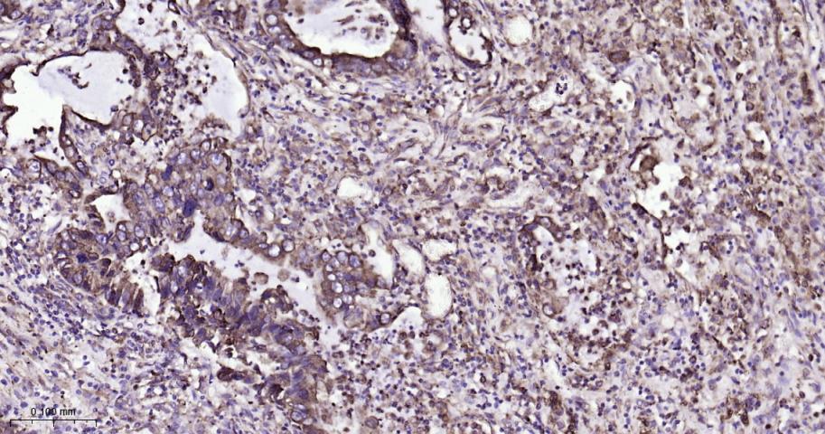 P4HB Recombinant Rabbit mAb(bs