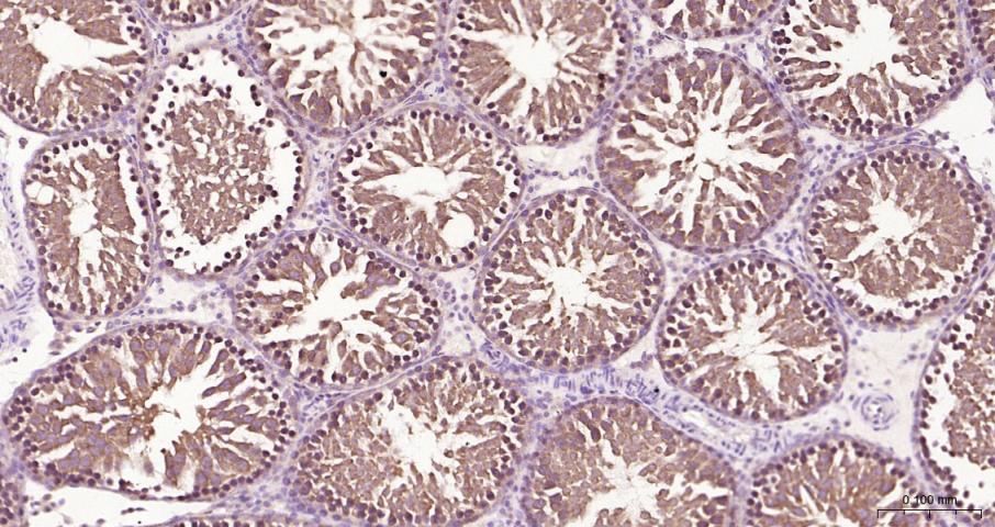 eIF4E Recombinant Rabbit mAb(b