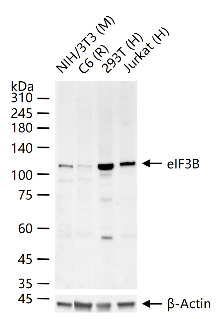eIF3B Recombinant Rabbit mAb(b