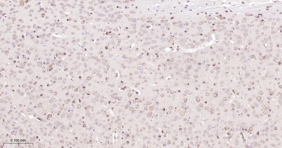 P4HB Recombinant Rabbit mAb(bs