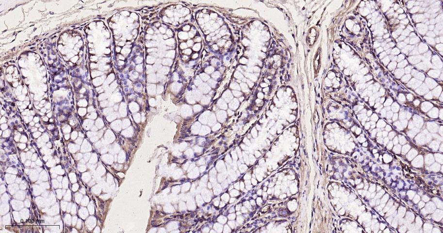 eIF3B Recombinant Rabbit mAb(b
