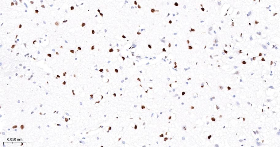 Oct-1 Recombinant Rabbit mAb(b