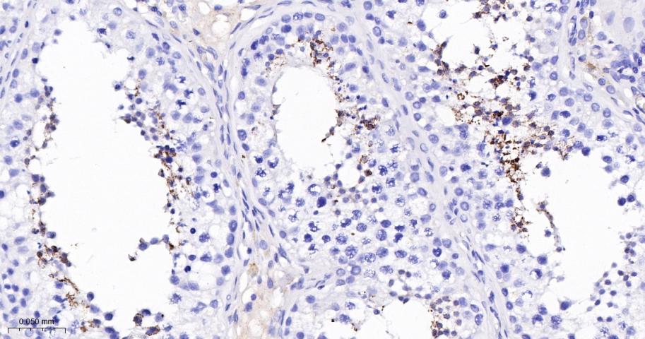 FTMT Recombinant Rabbit mAb(bs