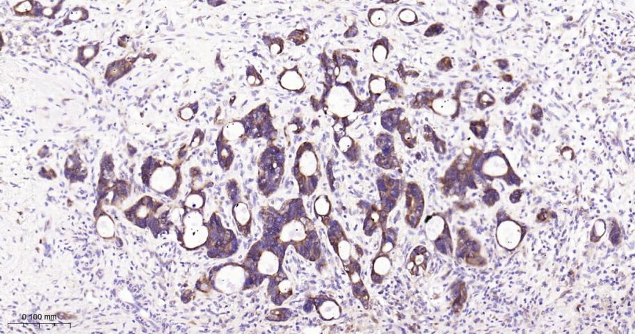 NME1/NM23A Recombinant Rabbit 