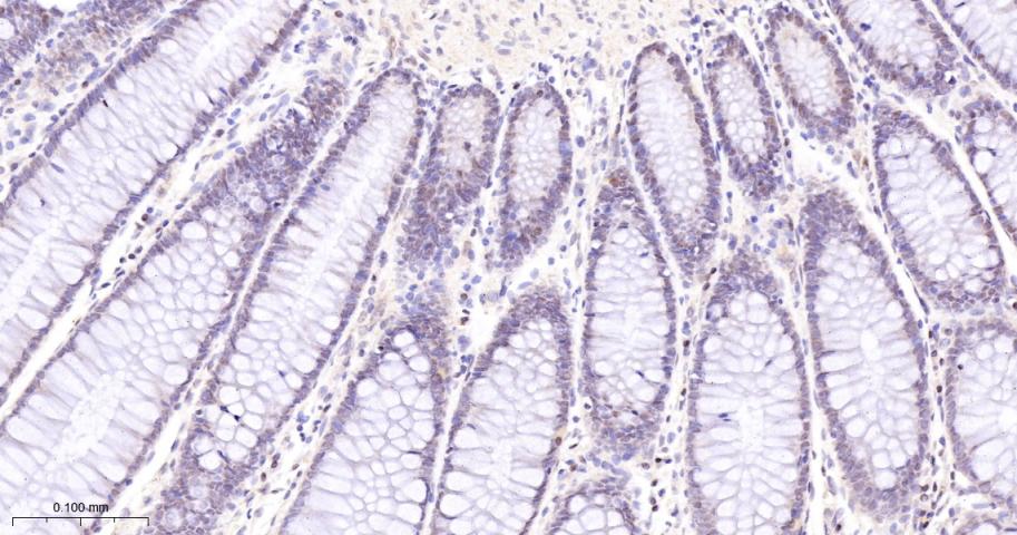 Cleaved PARP1 p25 Recombinant 