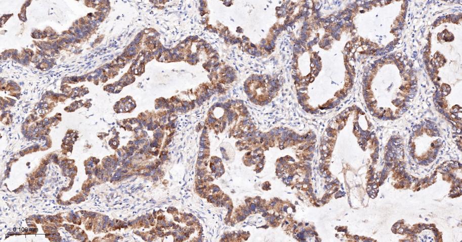 SERCA2 Recombinant Rabbit mAb(