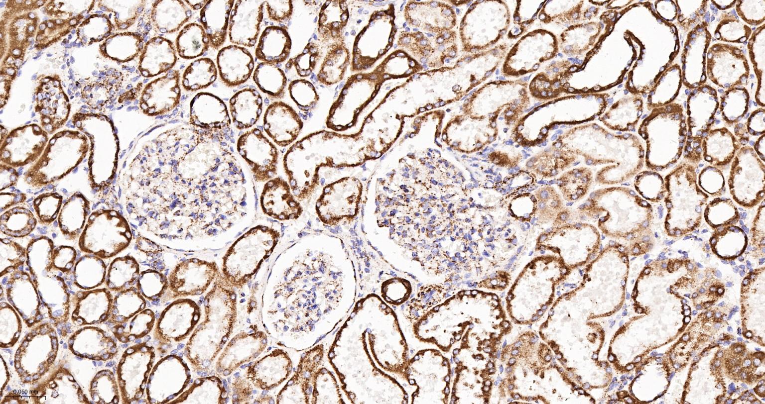 MDH2 Recombinant Rabbit mAb(bs