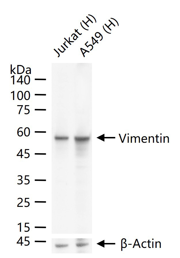 Vimentin Recombinant Rabbit mA
