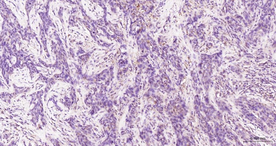 eIF4E Recombinant Rabbit mAb(b
