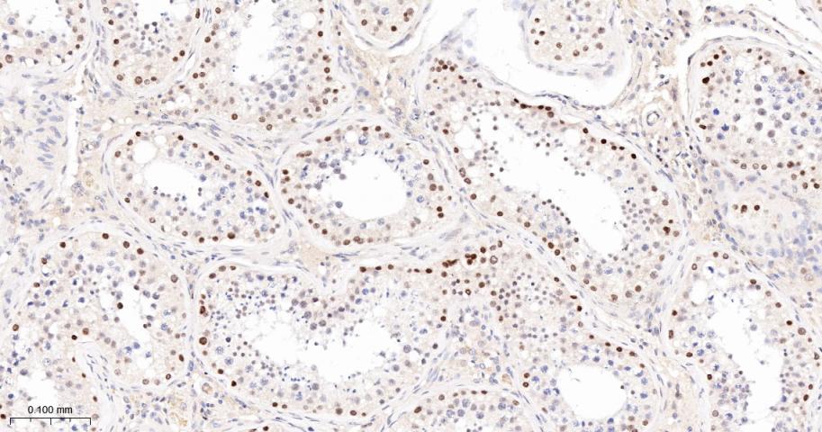 Cleaved PARP1 p25 Recombinant 