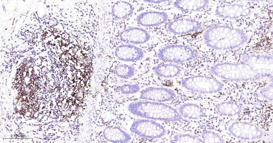 HLA-DRA Mouse mAb(bsm-51091M)-