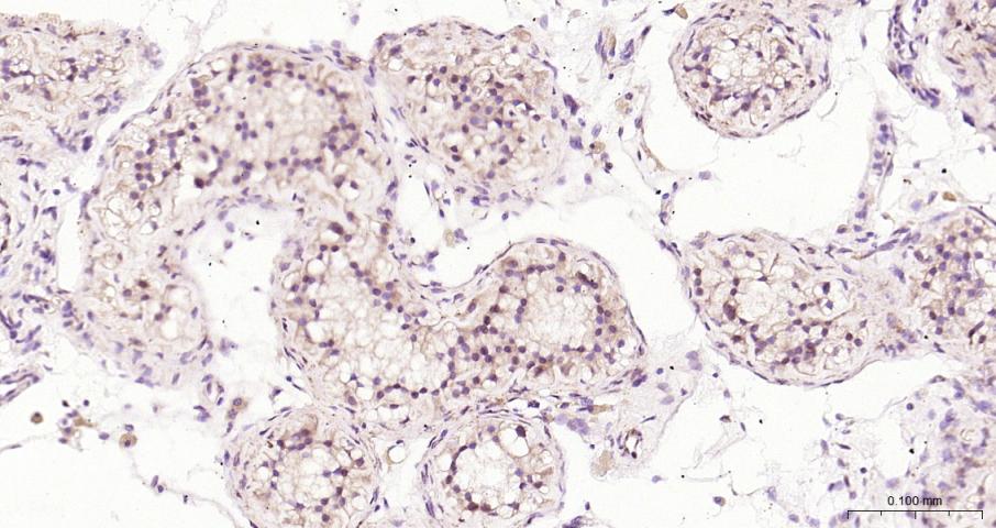 eIF4E Recombinant Rabbit mAb(b