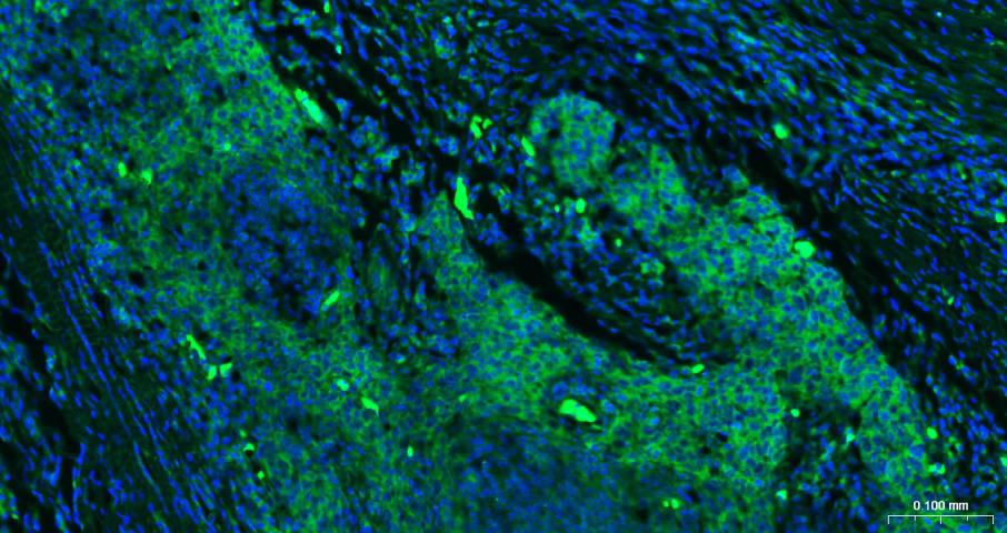 eIF4E Recombinant Rabbit mAb(b