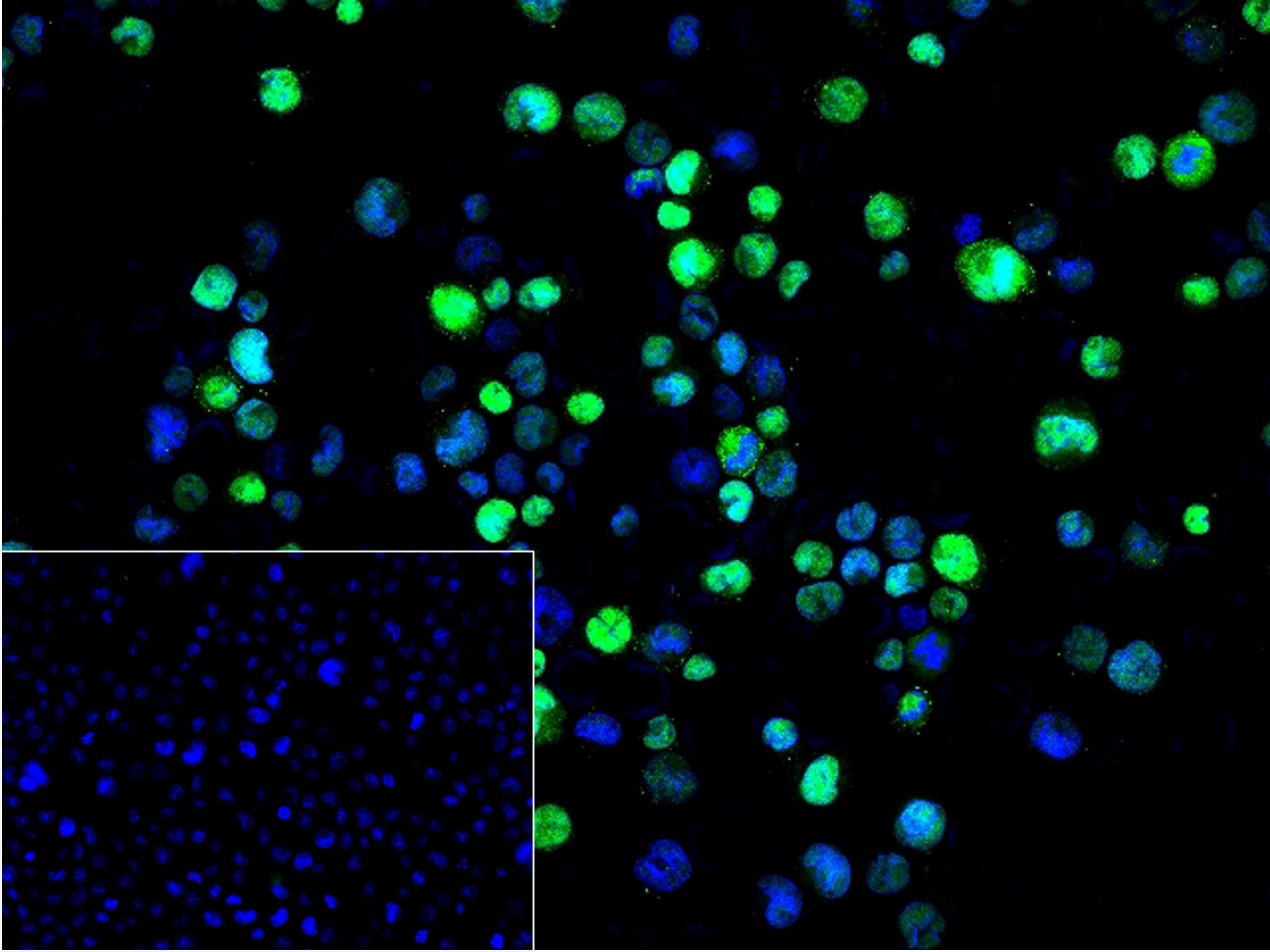 SATB2 Recombinant Rabbit mAb(b