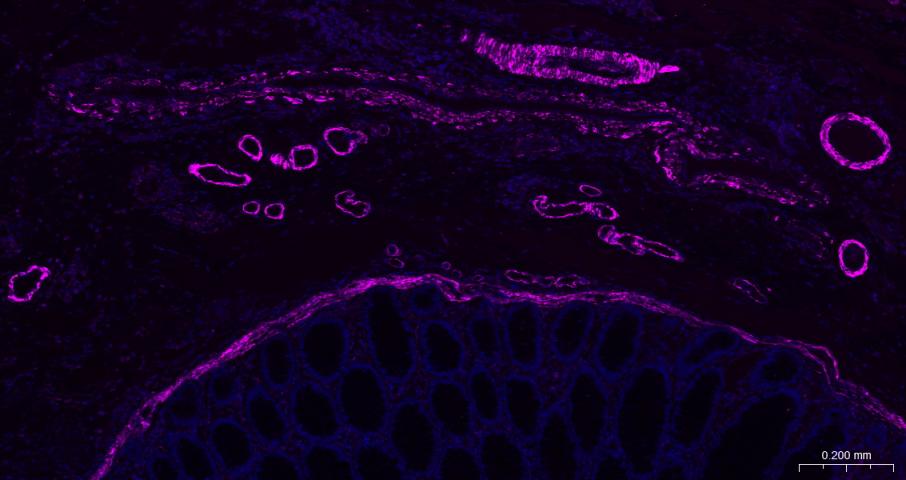 alpha smooth muscle Actin Mous