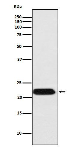 FTMT Recombinant Rabbit mAb(bs