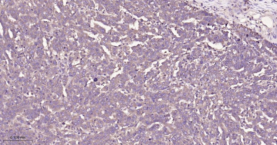 eIF3B Recombinant Rabbit mAb(b