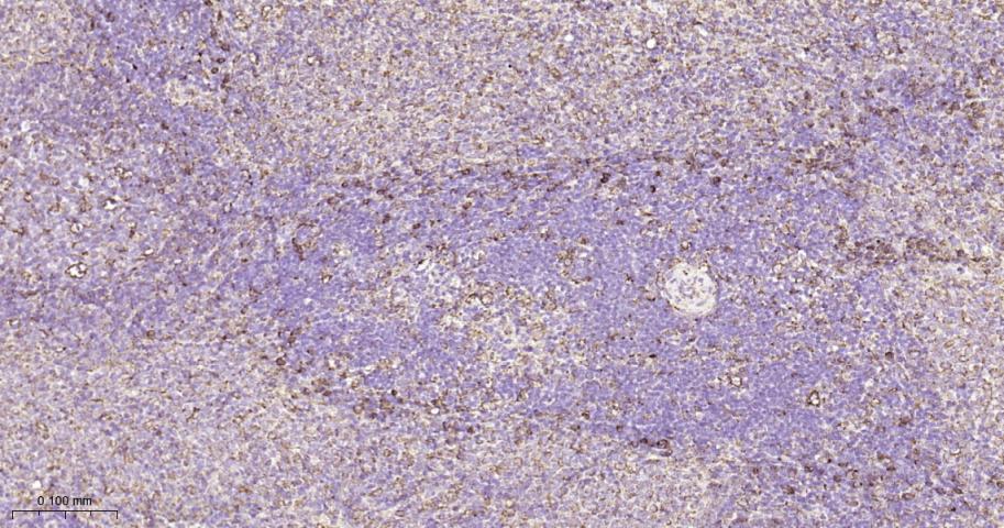 P4HB Recombinant Rabbit mAb(bs