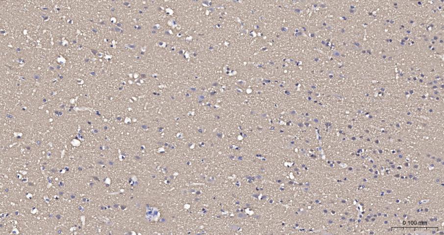 beta I Tubulin Recombinant Rab