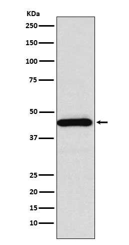 Somatostatin Receptor 5 Recomb